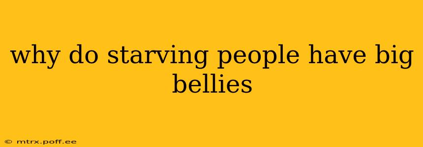 why do starving people have big bellies
