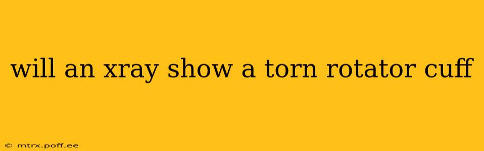 will an xray show a torn rotator cuff